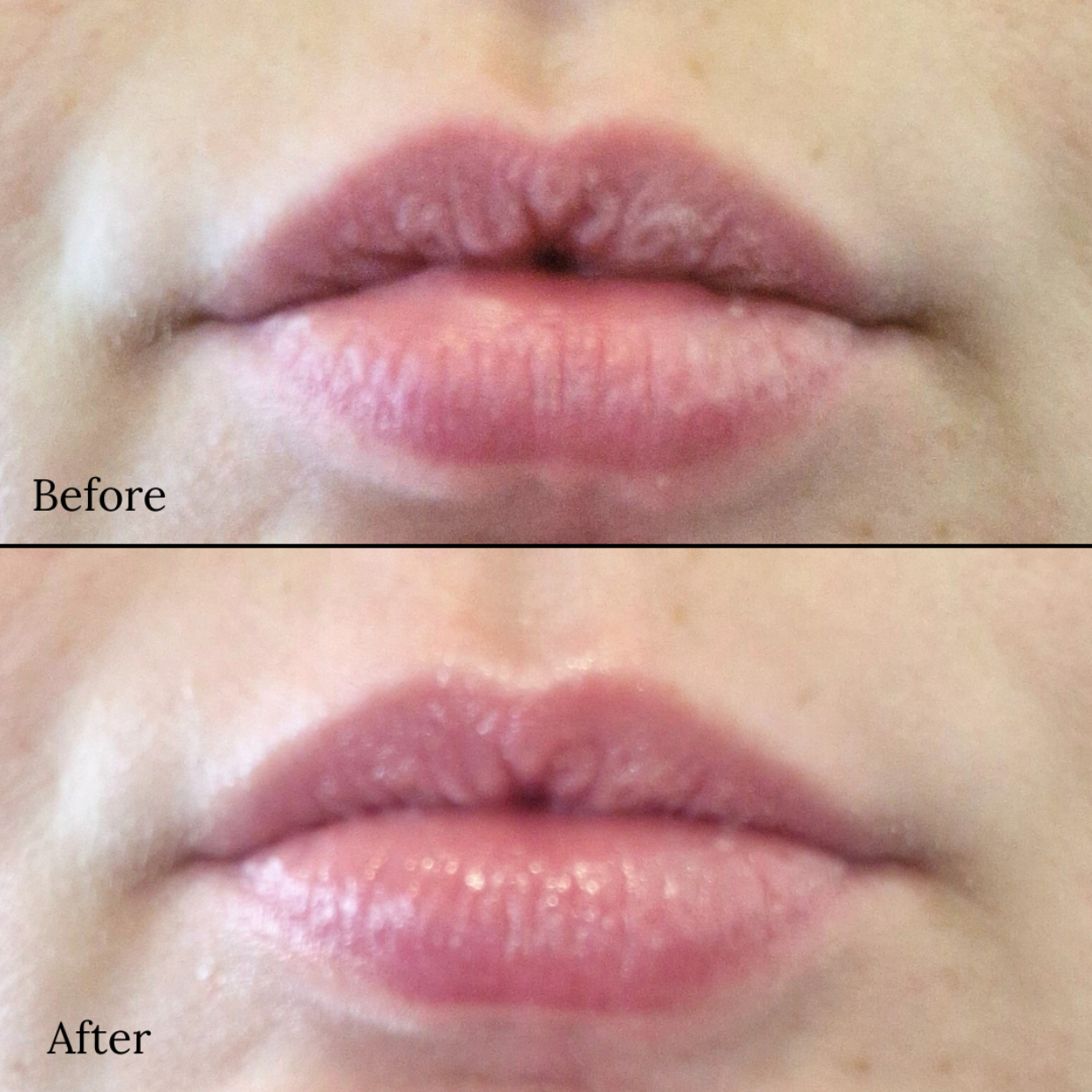 Before and after comparison of lips with 'Before' on top and 'After' on bottom.